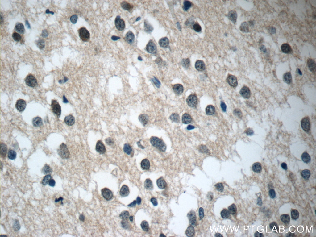 Immunohistochemistry (IHC) staining of human brain tissue using C21orf58 Polyclonal antibody (25024-1-AP)