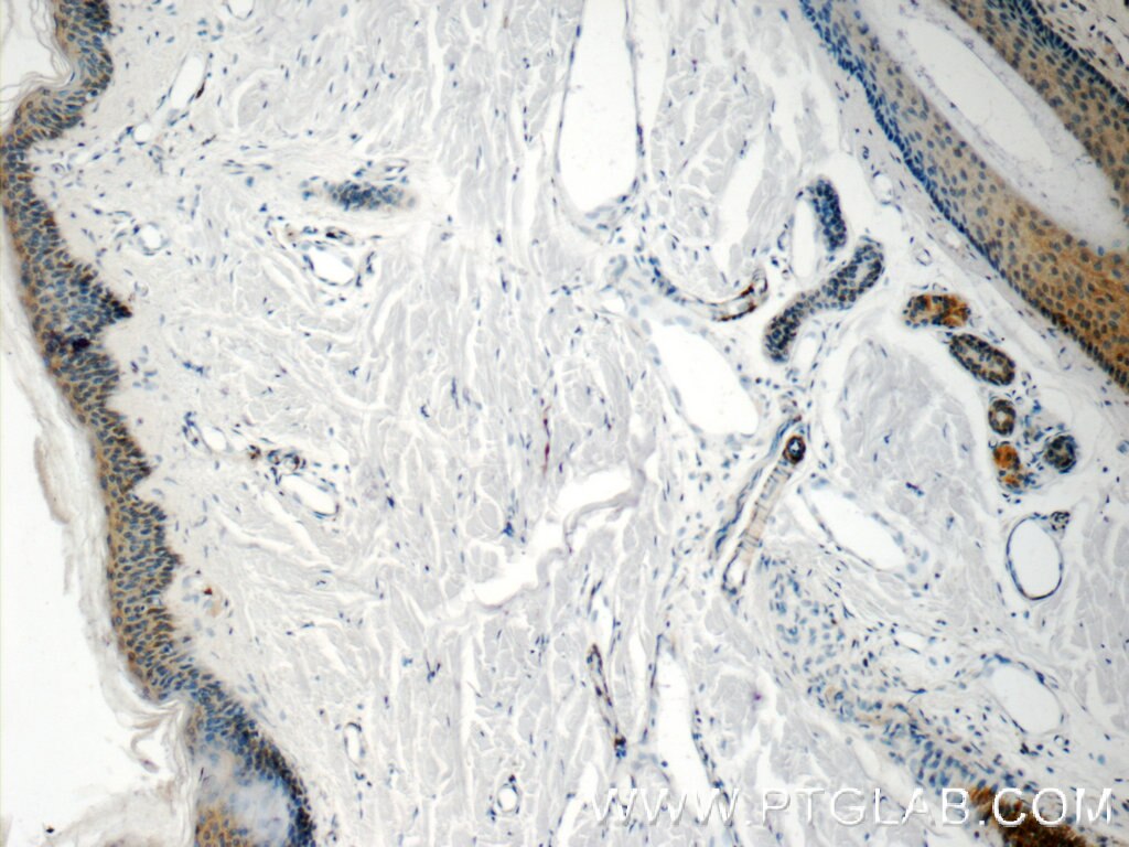 Immunohistochemistry (IHC) staining of human skin tissue using C21orf58 Polyclonal antibody (25024-1-AP)