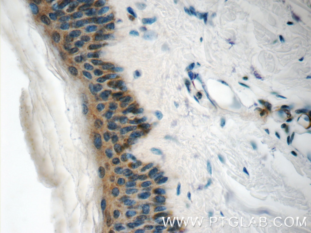 Immunohistochemistry (IHC) staining of human skin tissue using C21orf58 Polyclonal antibody (25024-1-AP)