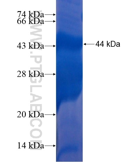 C21orf58 fusion protein Ag21758 SDS-PAGE