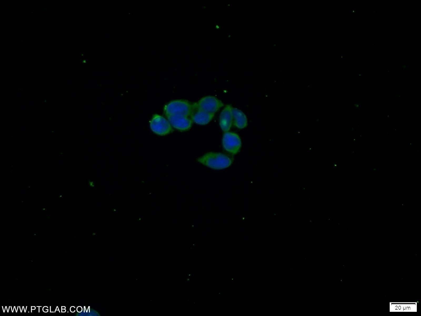 Immunofluorescence (IF) / fluorescent staining of HEK-293 cells using C21orf59 Polyclonal antibody (21461-1-AP)