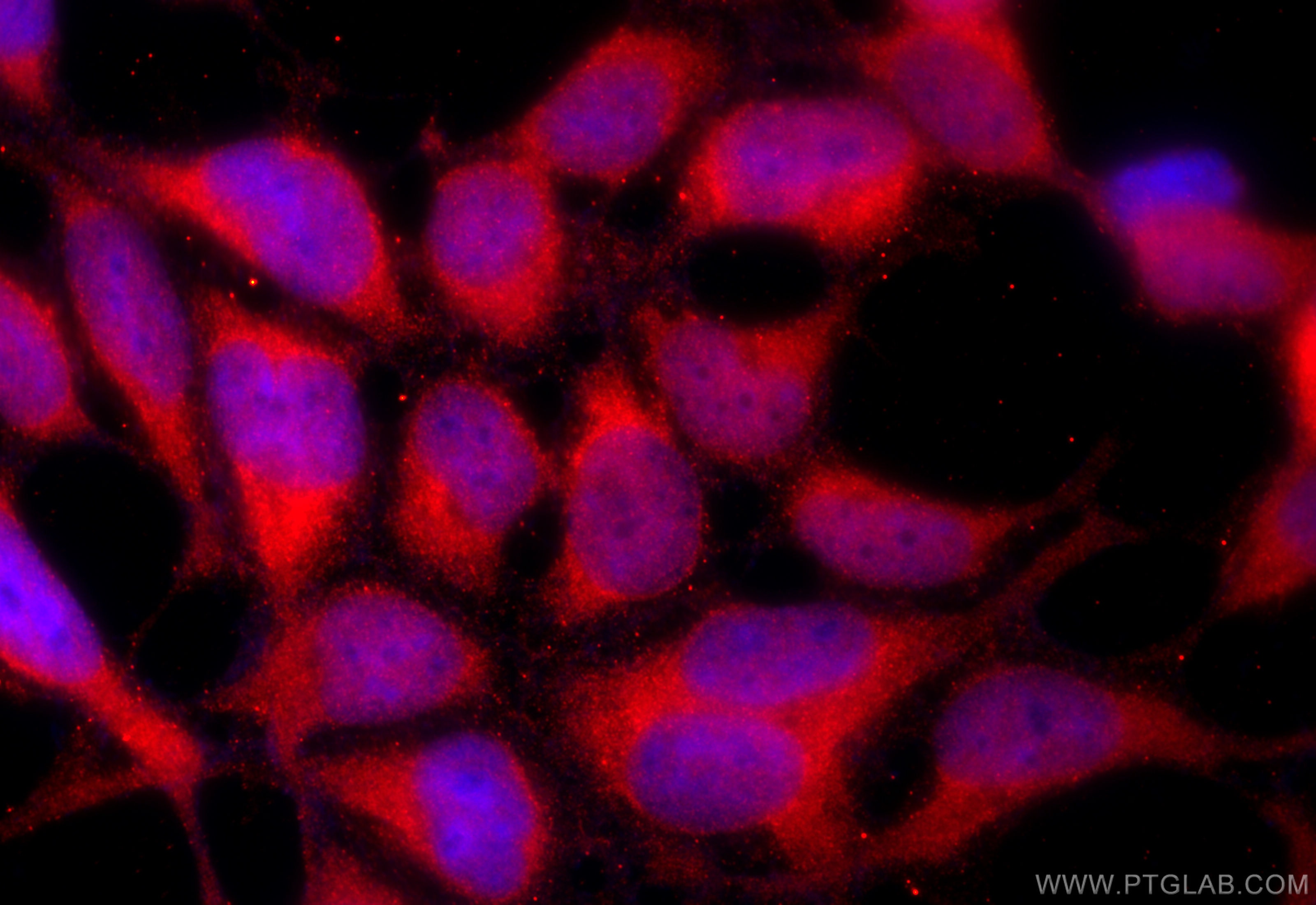 Immunofluorescence (IF) / fluorescent staining of HEK-293 cells using C21orf59 Polyclonal antibody (21461-1-AP)