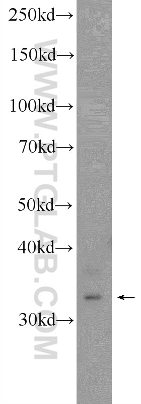 WB analysis of MCF-7 using 21461-1-AP