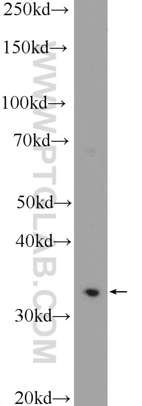 Western Blot (WB) analysis of K-562 cells using C21orf59 Polyclonal antibody (21461-1-AP)