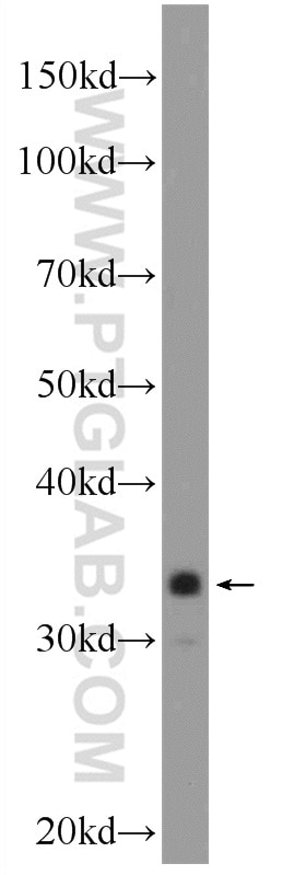 Western Blot (WB) analysis of PC-3 cells using C21orf59 Polyclonal antibody (21461-1-AP)