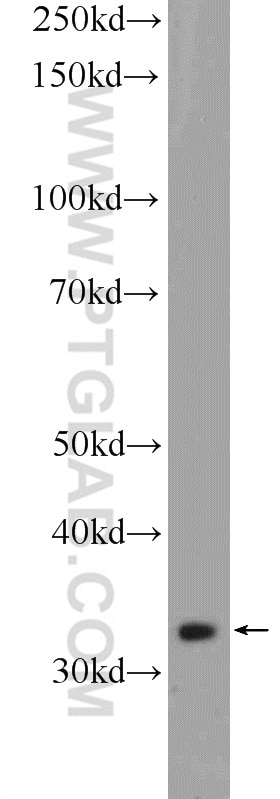 Western Blot (WB) analysis of K-562 cells using C21orf59 Polyclonal antibody (21461-1-AP)