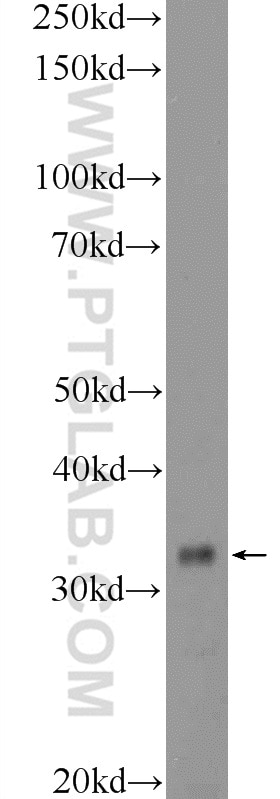 WB analysis of HeLa using 21461-1-AP