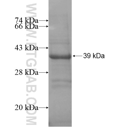 C21orf59 fusion protein Ag14994 SDS-PAGE