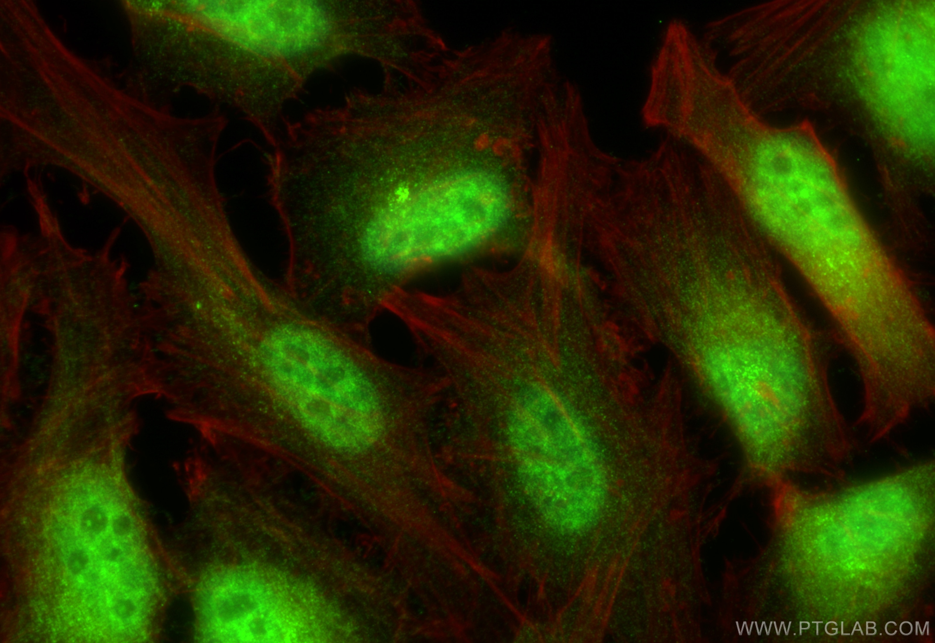 Immunofluorescence (IF) / fluorescent staining of HeLa cells using C21orf66 Polyclonal antibody (21357-1-AP)