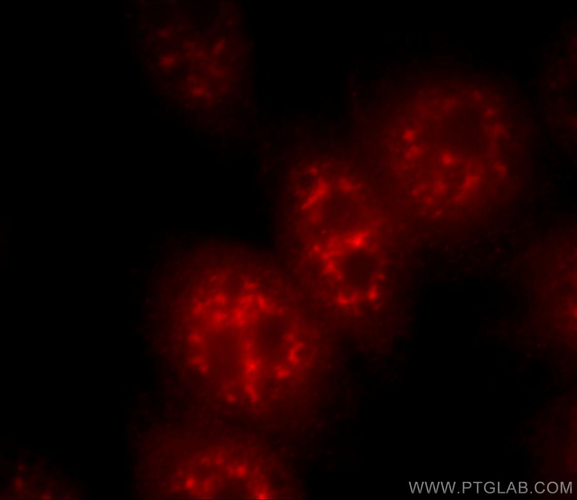 Immunofluorescence (IF) / fluorescent staining of HeLa cells using C21orf66 Polyclonal antibody (21357-1-AP)