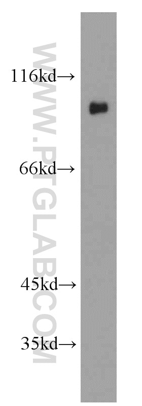 Western Blot (WB) analysis of human brain tissue using C21orf66 Polyclonal antibody (21357-1-AP)