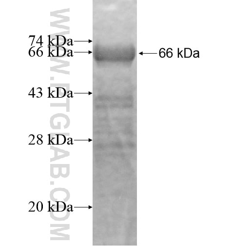 C21orf66 fusion protein Ag15789 SDS-PAGE