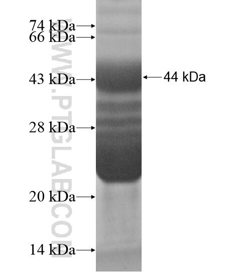 C21orf67 fusion protein Ag19540 SDS-PAGE