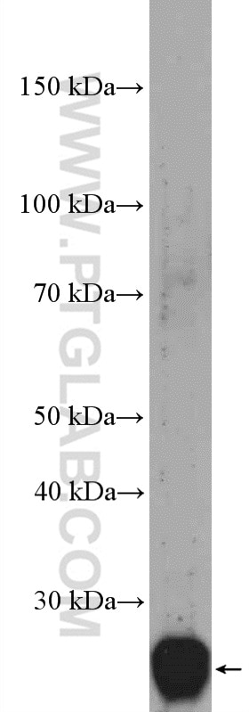 Western Blot (WB) analysis of HeLa cells using C21orf70 Polyclonal antibody (27447-1-AP)