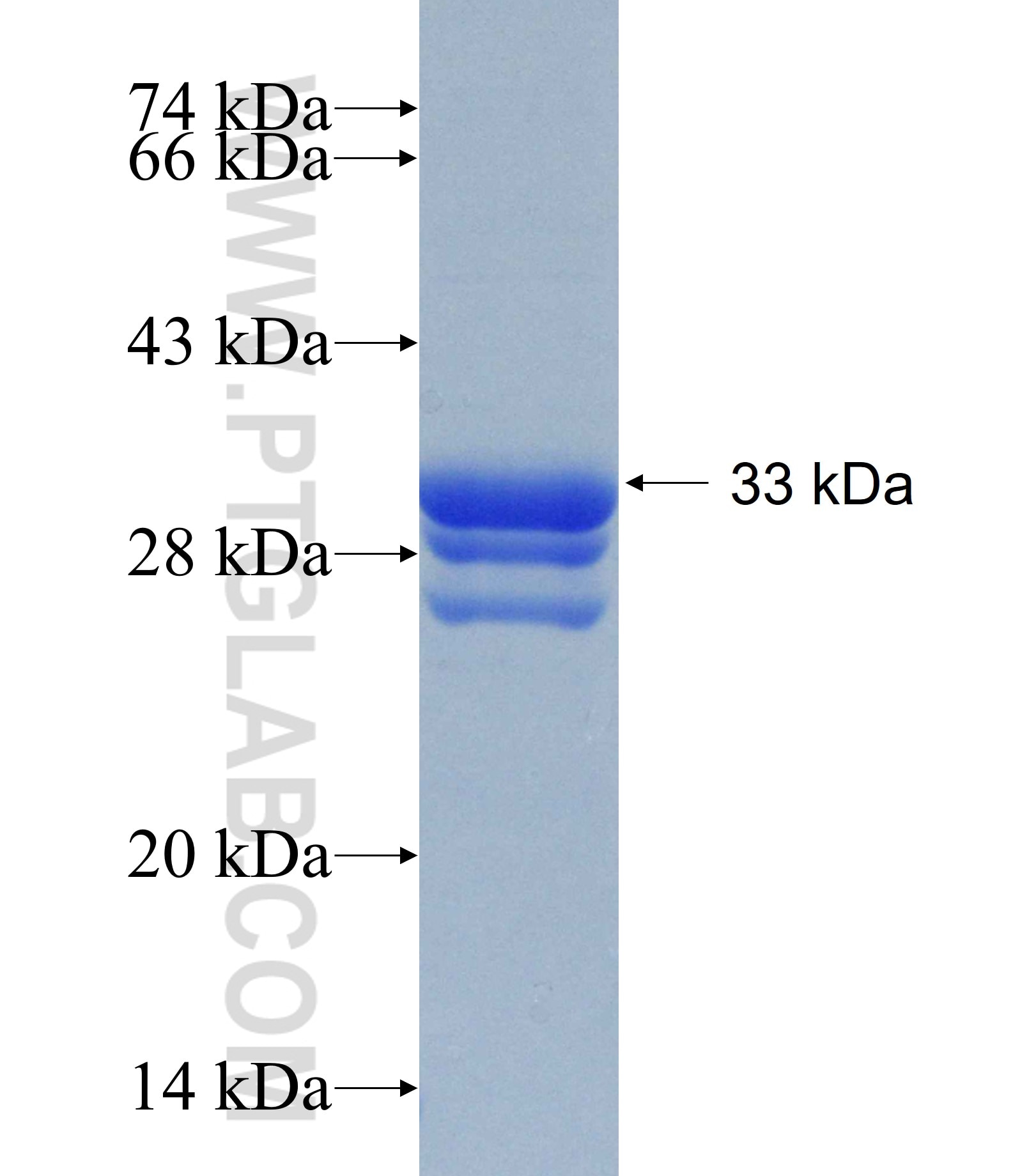 C21orf84 fusion protein Ag15724 SDS-PAGE