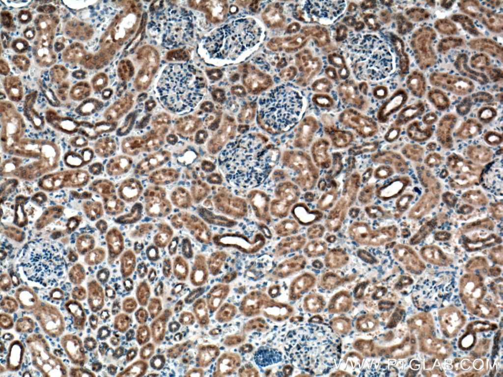 Immunohistochemistry (IHC) staining of human kidney tissue using C22orf25 Polyclonal antibody (27846-1-AP)
