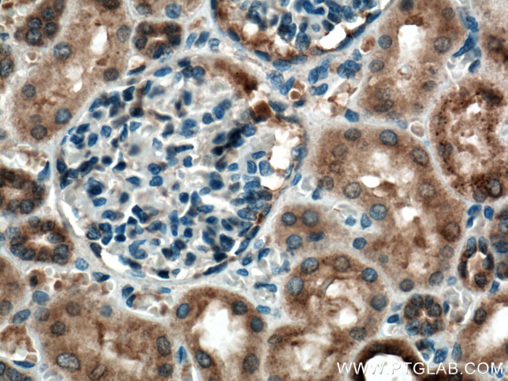 Immunohistochemistry (IHC) staining of human kidney tissue using C22orf25 Polyclonal antibody (27846-1-AP)