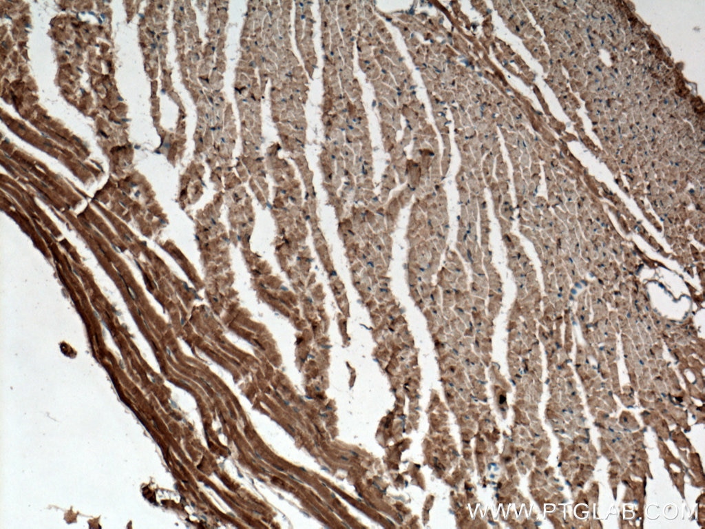 Immunohistochemistry (IHC) staining of mouse heart tissue using C22orf25 Polyclonal antibody (27846-1-AP)