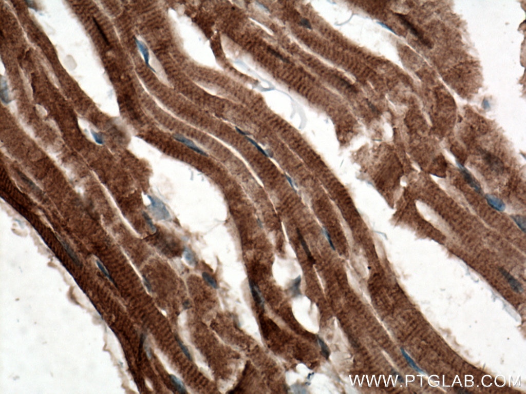 Immunohistochemistry (IHC) staining of mouse heart tissue using C22orf25 Polyclonal antibody (27846-1-AP)