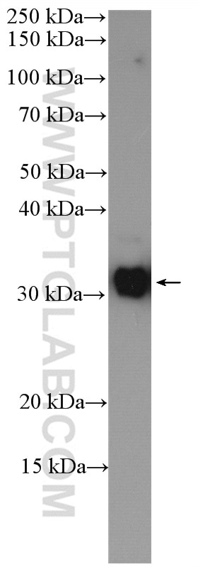 Western Blot (WB) analysis of mouse kidney tissue using C22orf25 Polyclonal antibody (27846-1-AP)