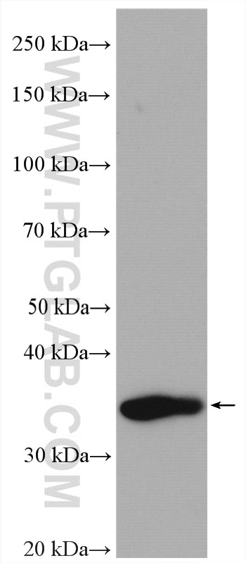 Western Blot (WB) analysis of mouse kidney tissue using C22orf25 Polyclonal antibody (27846-1-AP)