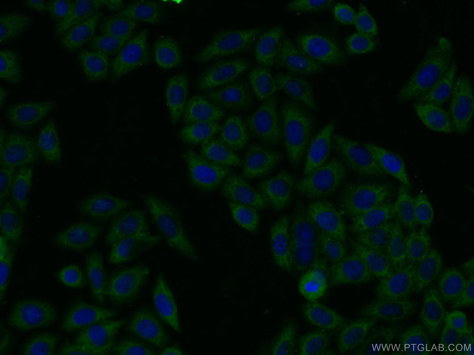 Immunofluorescence (IF) / fluorescent staining of HeLa cells using RtcB-Specific Polyclonal antibody (19809-1-AP)