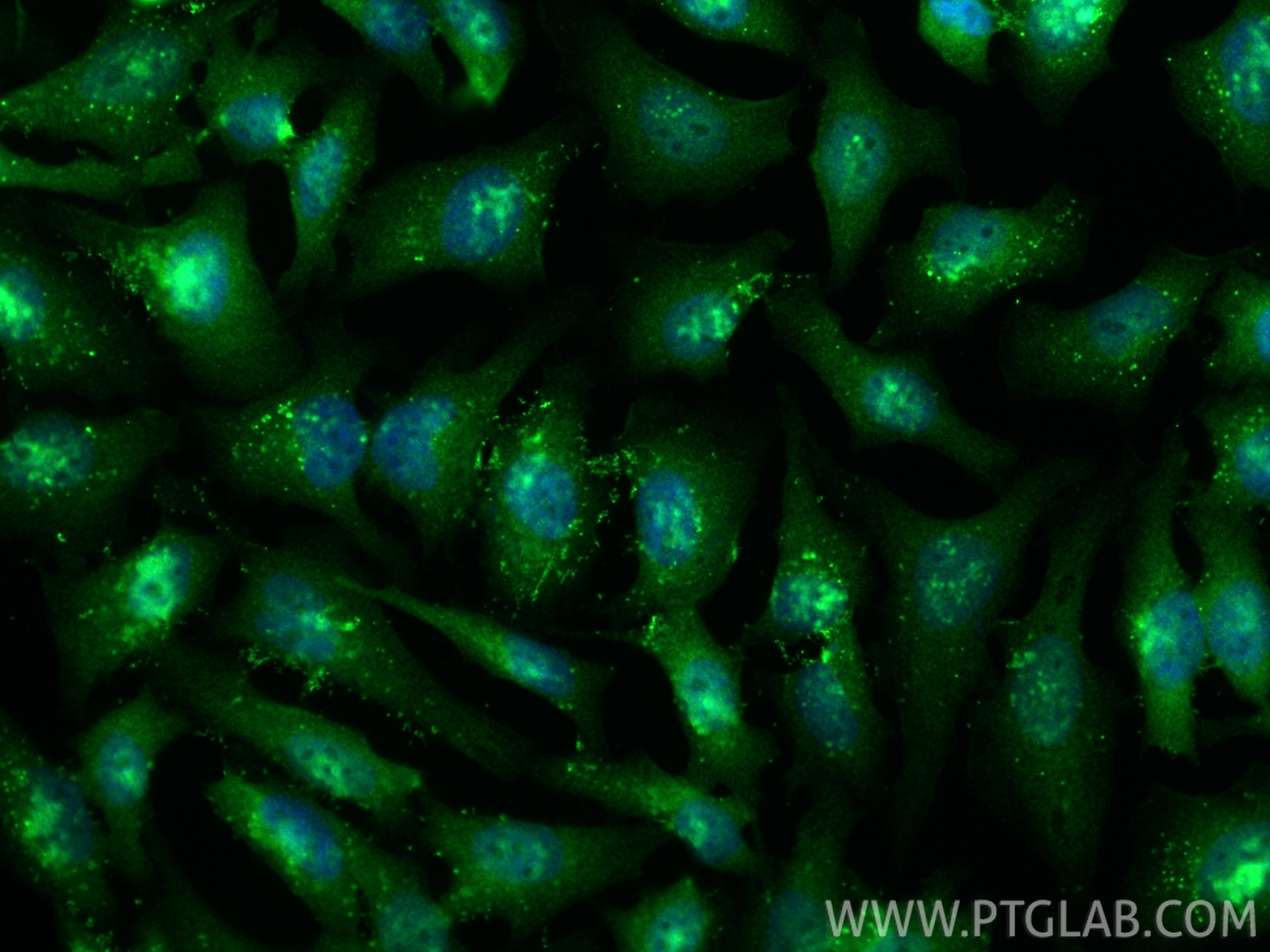 Immunofluorescence (IF) / fluorescent staining of HeLa cells using RTCB-Specific Polyclonal antibody (19809-1-AP)