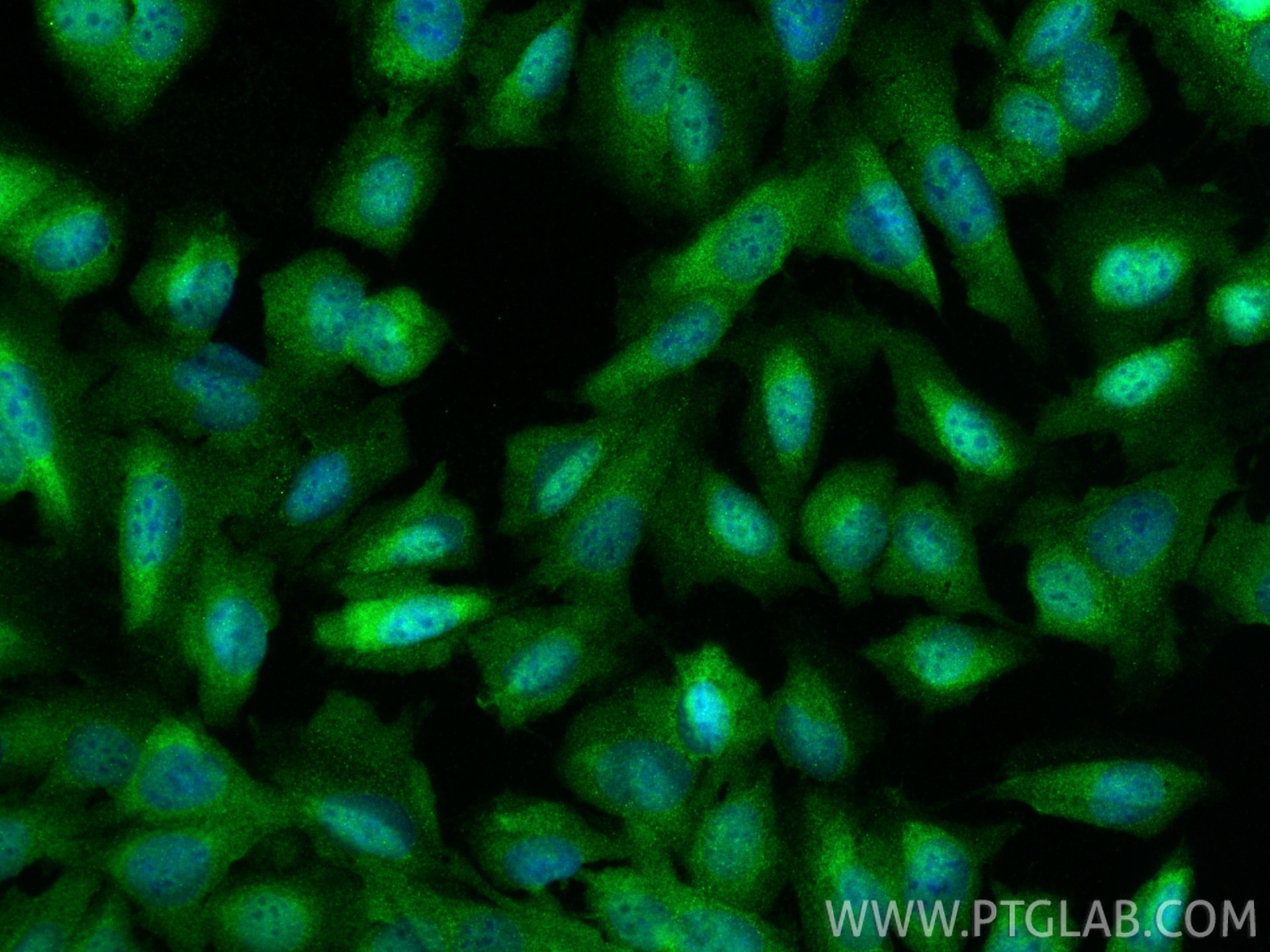 Immunofluorescence (IF) / fluorescent staining of U2OS cells using RTCB-Specific Polyclonal antibody (19809-1-AP)