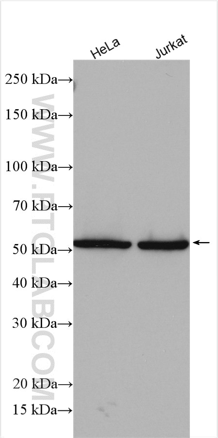 Western Blot (WB) analysis of various lysates using RtcB-Specific Polyclonal antibody (19809-1-AP)