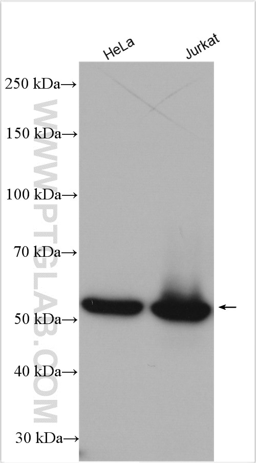 Western Blot (WB) analysis of various lysates using RTCB-Specific Polyclonal antibody (19809-1-AP)