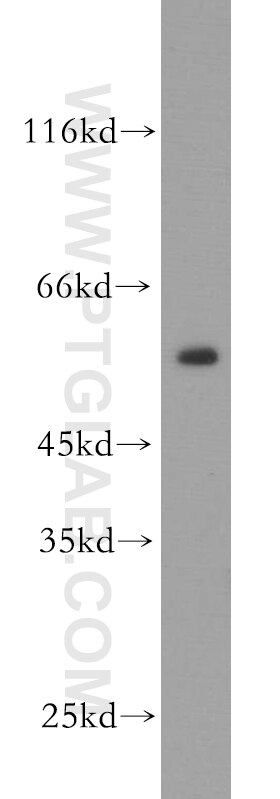 Western Blot (WB) analysis of mouse brain tissue using RtcB-Specific Polyclonal antibody (19809-1-AP)