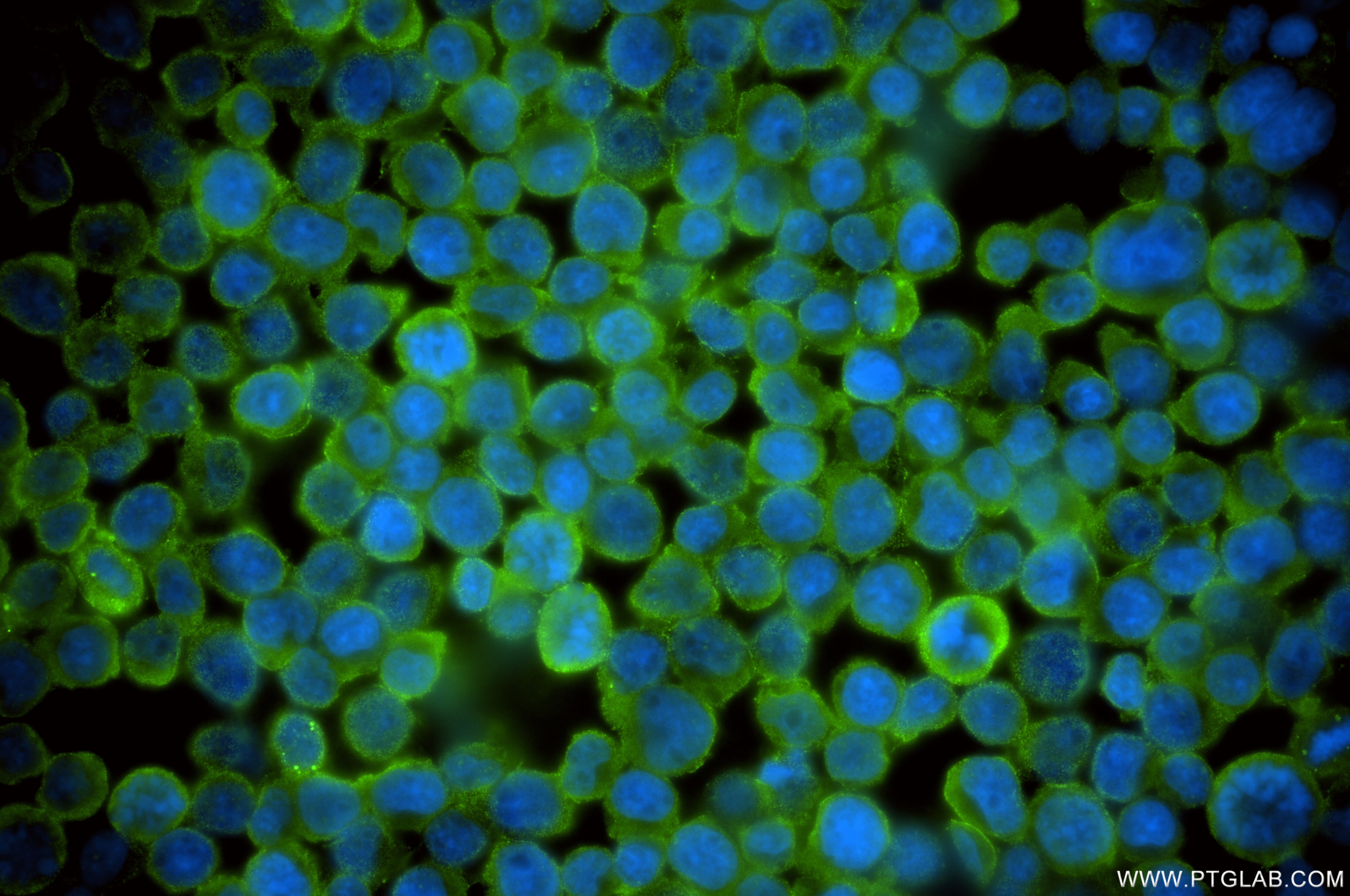 Immunofluorescence (IF) / fluorescent staining of Jurkat cells using RTCB Recombinant antibody (86258-4-RR)