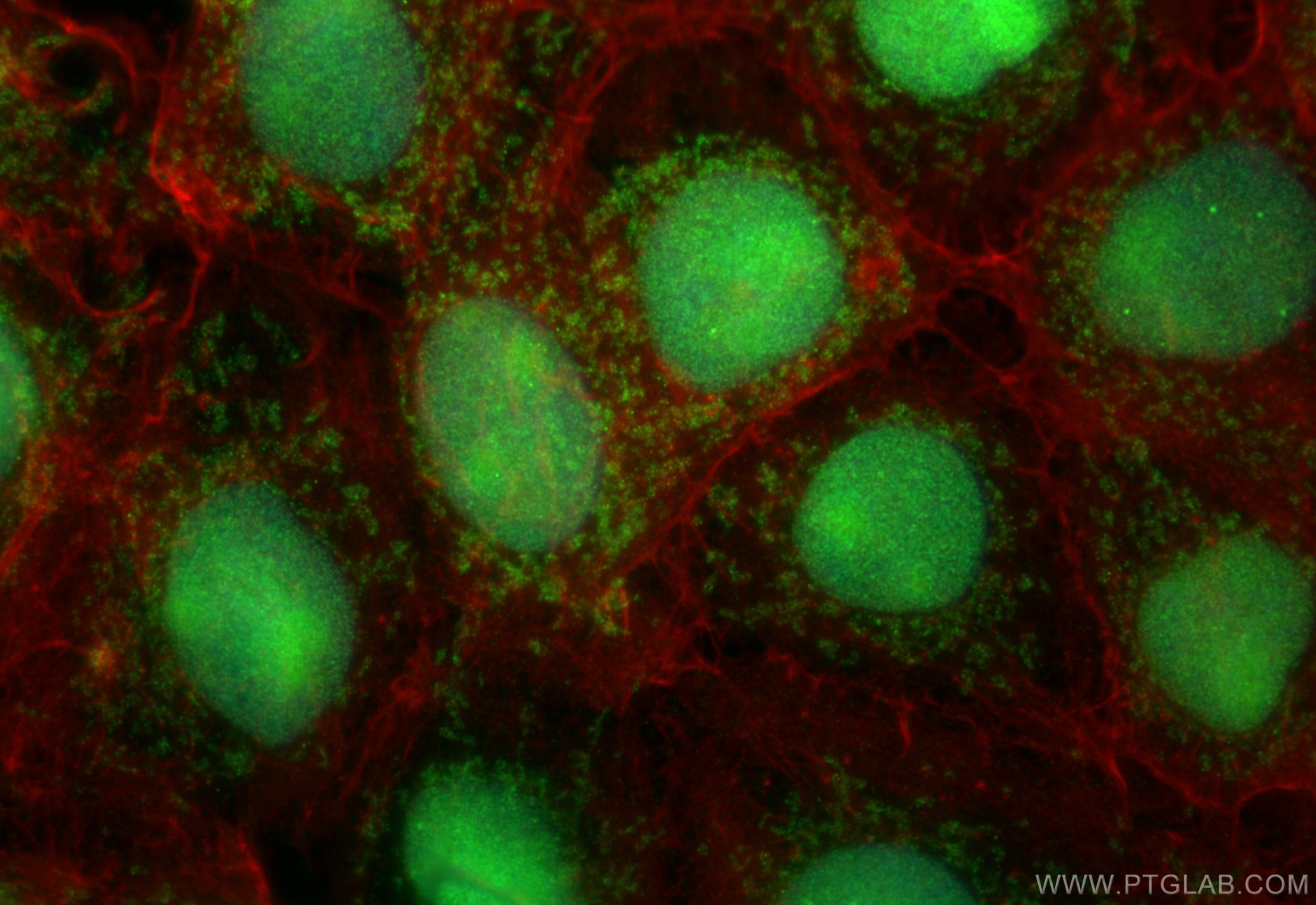 Immunofluorescence (IF) / fluorescent staining of A431 cells using C22orf32 Polyclonal antibody (29313-1-AP)