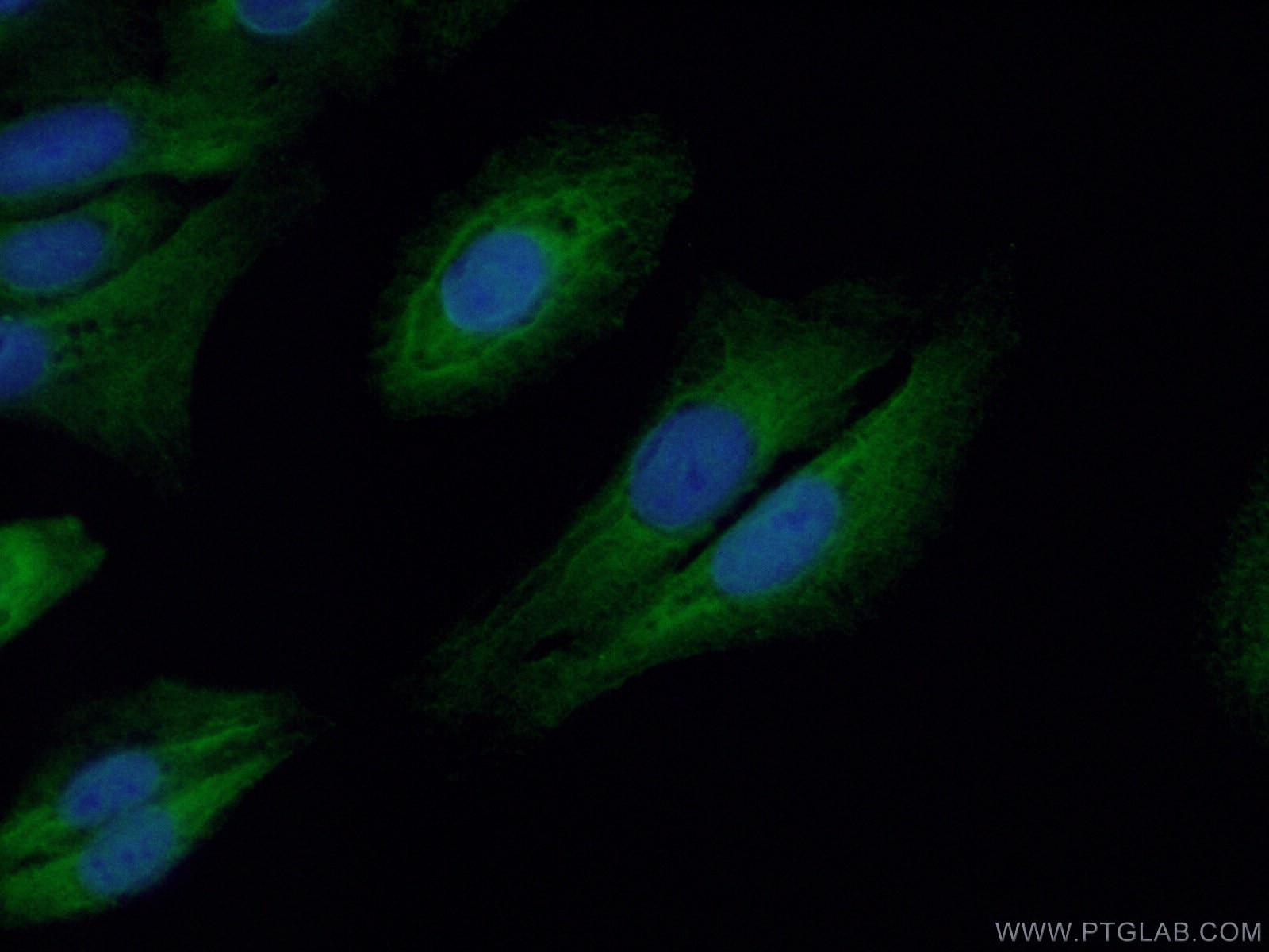 Immunofluorescence (IF) / fluorescent staining of U2OS cells using C22orf33 Polyclonal antibody (26577-1-AP)