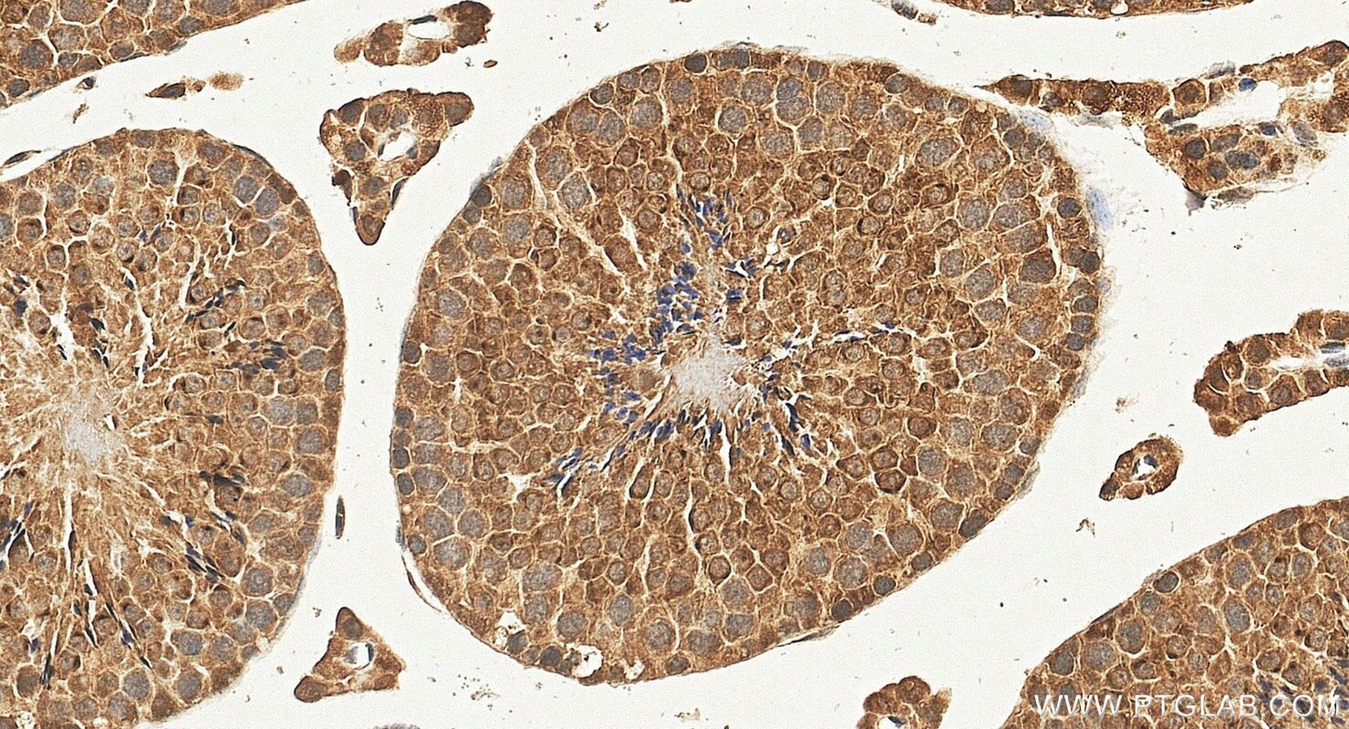 Immunohistochemistry (IHC) staining of mouse testis tissue using C22orf33 Polyclonal antibody (26577-1-AP)