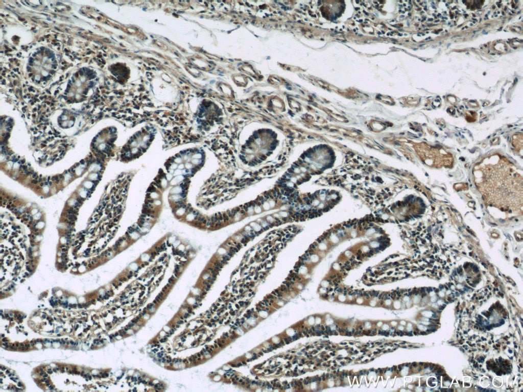 Immunohistochemistry (IHC) staining of human small intestine tissue using C22orf41 Polyclonal antibody (24867-1-AP)