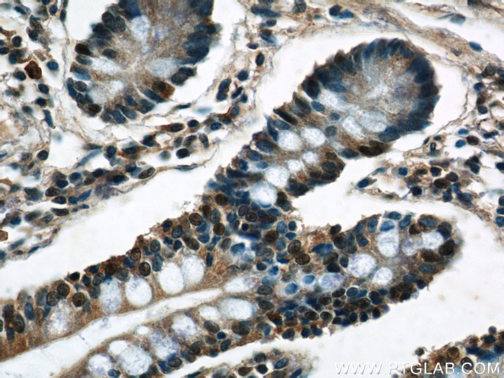 Immunohistochemistry (IHC) staining of human small intestine tissue using C22orf41 Polyclonal antibody (24867-1-AP)