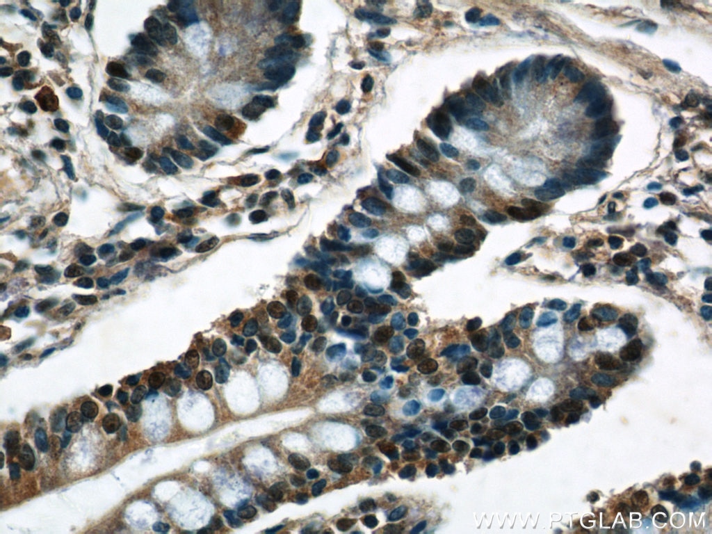 IHC staining of human small intestine using 24867-1-AP