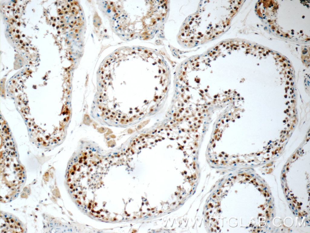 Immunohistochemistry (IHC) staining of human testis tissue using C22orf41 Polyclonal antibody (24867-1-AP)