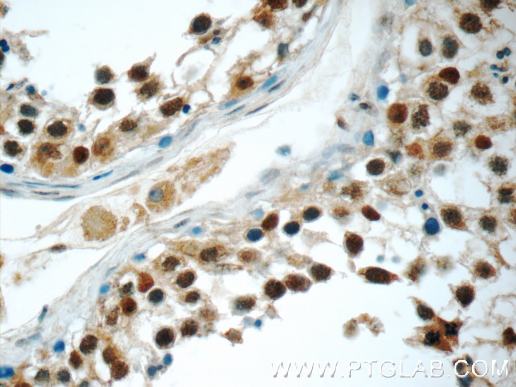 IHC staining of human testis using 24867-1-AP