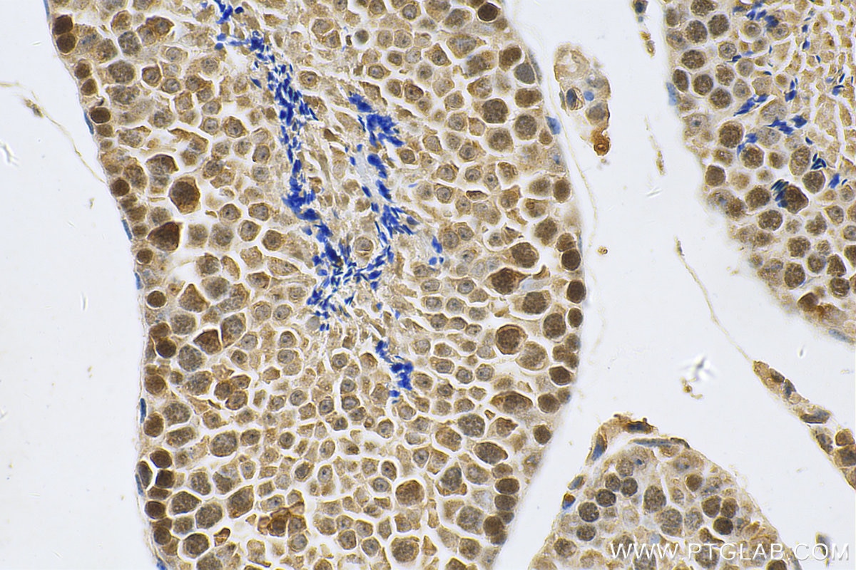 Immunohistochemistry (IHC) staining of mouse testis tissue using C22orf41 Polyclonal antibody (24867-1-AP)