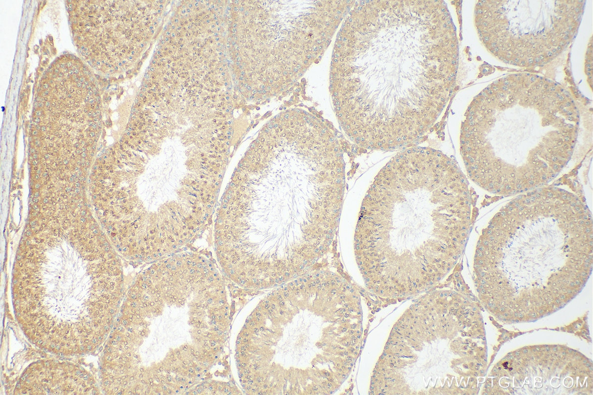 Immunohistochemistry (IHC) staining of rat testis tissue using C22orf41 Polyclonal antibody (24867-1-AP)