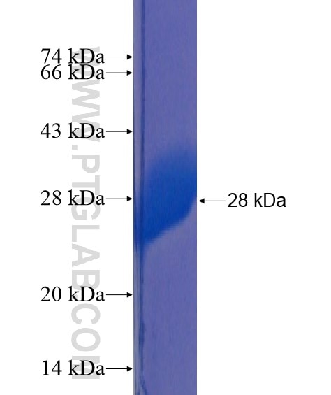 C22orf41 fusion protein Ag21756 SDS-PAGE