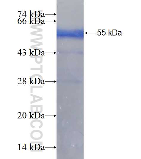 C2orf27B fusion protein Ag19533 SDS-PAGE