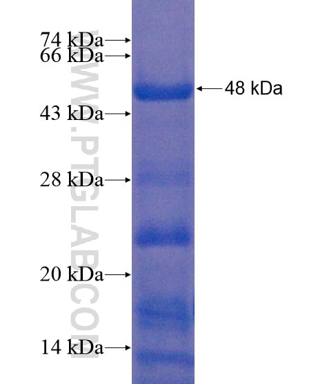C2orf29 fusion protein Ag22308 SDS-PAGE