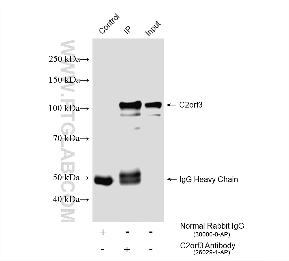 Immunoprecipitation (IP) experiment of HL-60 cells using C2orf3 Polyclonal antibody (26029-1-AP)