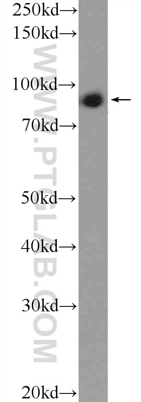 Western Blot (WB) analysis of HepG2 cells using C2orf3 Polyclonal antibody (26029-1-AP)