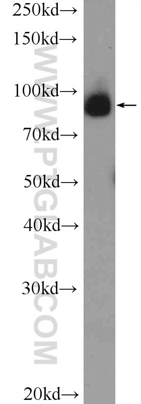 Western Blot (WB) analysis of PC-3 cells using C2orf3 Polyclonal antibody (26029-1-AP)