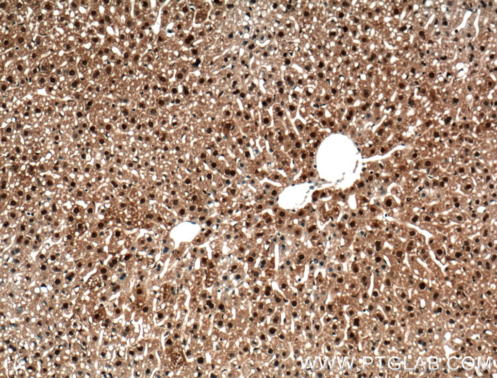Immunohistochemistry (IHC) staining of mouse liver tissue using C2orf37 Polyclonal antibody (26033-1-AP)