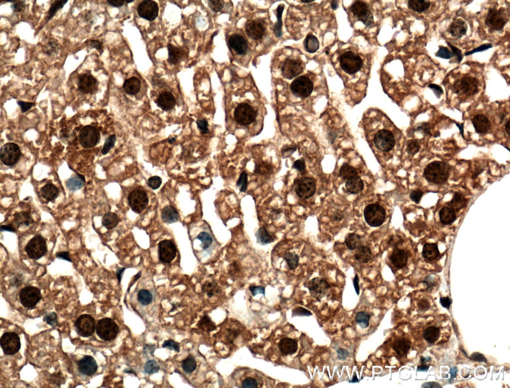 Immunohistochemistry (IHC) staining of mouse liver tissue using C2orf37 Polyclonal antibody (26033-1-AP)